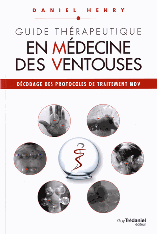 Guide Thérapeutique en médecine des ventouses