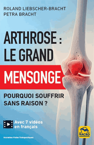 Arthrose : le grand mensonge